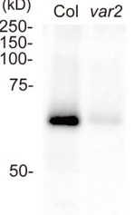 FtsH2 + FtsH8 | ATP-dependent zinc metalloprotease FtsH2 + FtsH8 (chloroplastic) in the group Antibodies Plant/Algal / Photosynthesis / Proteases at Agrisera AB (Antibodies for research) (AS16 3929)